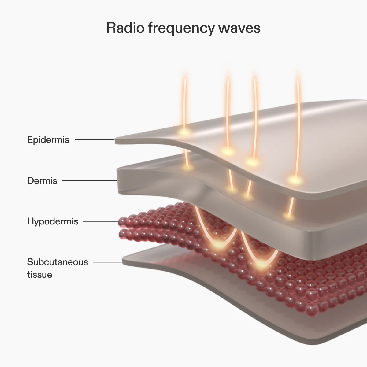 CurrentBody Skin RF Radio Frequency Skin Tightening Device - Image 4